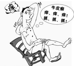 如何避免银屑病反复发作